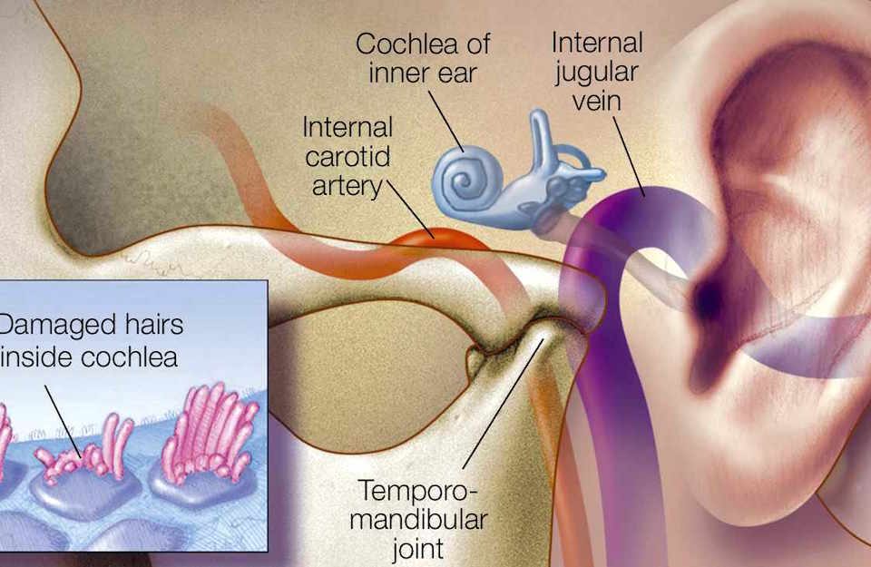Tinnitus Professional Members | Metro Hearing and Tinnitus Treatment Centre